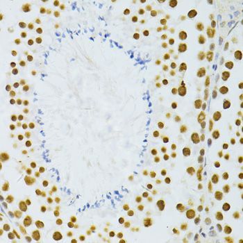 Immunohistochemistry - ALYREF antibody (144-06010)