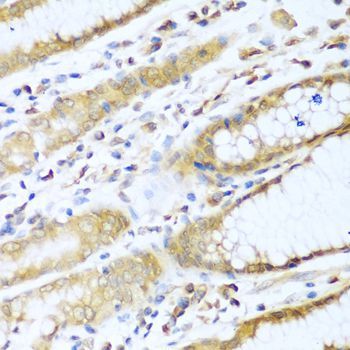 Immunohistochemistry - UBE2L3 Polyclonal Antibody (144-04175)