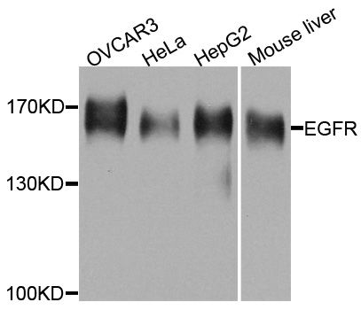 Western blot - [KO Validated] EGFR Polyclonal Antibody (144-11351)
