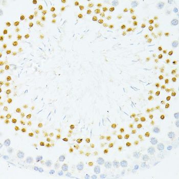 Immunohistochemistry - PVALB antibody (144-60383)