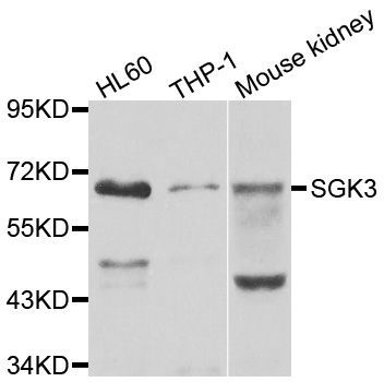 Western blot - SGK3 antibody (144-07586)