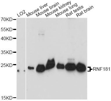 Western blot - RNF181 antibody (144-014405)