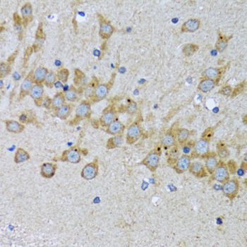 Immunohistochemistry - EIF2AK4 antibody (144-12618)