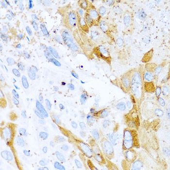 Immunohistochemistry - SPINT1 antibody (144-06411)