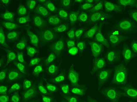 Immunofluorescence - CHEK2 Polyclonal Antibody (144-60023)