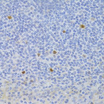 Immunohistochemistry - FCN1 Antibody (144-06587)