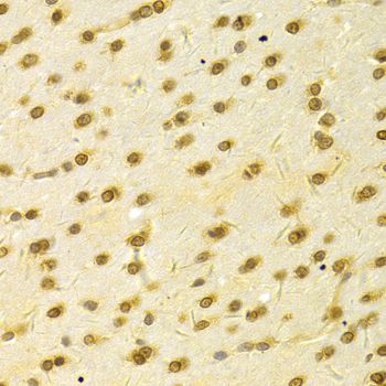 Immunohistochemistry - HDGF Antibody (144-05347)