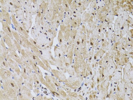 Immunohistochemistry - HUS1 antibody (144-60528)