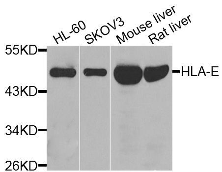 Western blot - HLA-E antibody (144-08429)