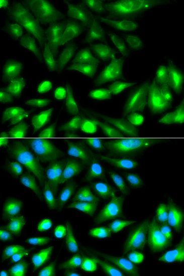 Western blot - [KO Validated] RHOC Polyclonal Antibody (144-01062)
