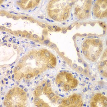 Immunohistochemistry - UBA6 Polyclonal Antibody (144-07511)