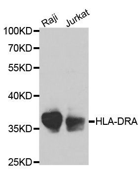Western blot - HLA-DRA antibody (144-01579)