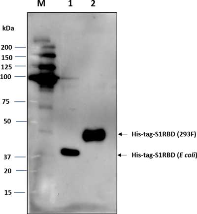 Western blot image