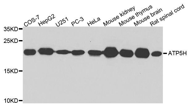 Western blot - ATP5H Polyclonal Antibody (144-04425)