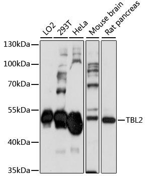 Western blot - TBL2 antibody (144-61051)