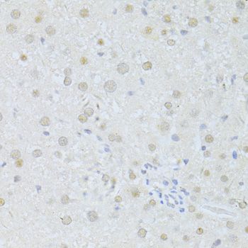Western blot - SIRT1 Polyclonal Antibody (144-011267)