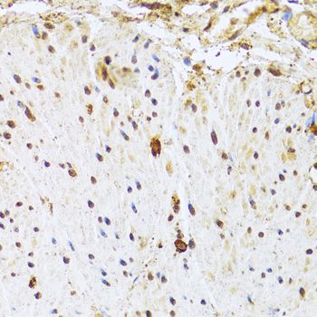 Immunohistochemistry - CDK4 Polyclonal Antibody (144-00366)