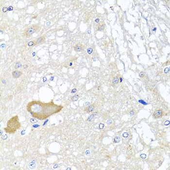 Immunohistochemistry - MCCC2 Polyclonal Antibody (144-07990)