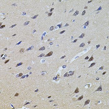 Immunohistochemistry - PLK4 antibody (144-09863)