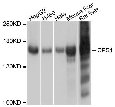 Western blot - CPS1 antibody (144-08080)