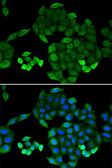 Immunofluorescence - PTS antibody (144-06306)