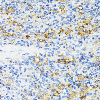 Immunohistochemistry - CD27 antibody (144-01945)