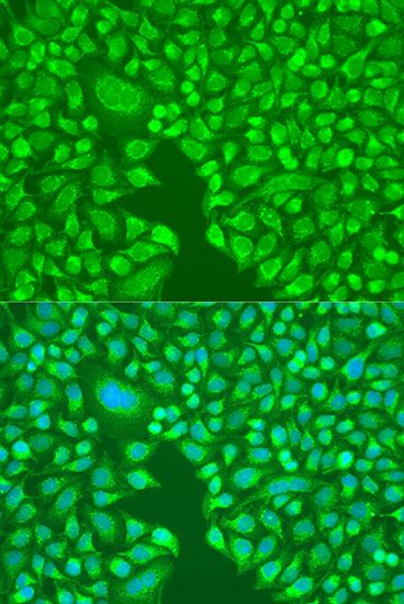 Immunofluorescence - ITGA6 antibody (144-03236)