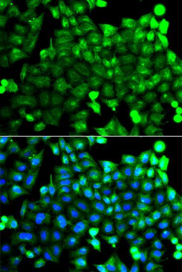 Immunofluorescence - NCALD Polyclonal Antibody (144-08000)