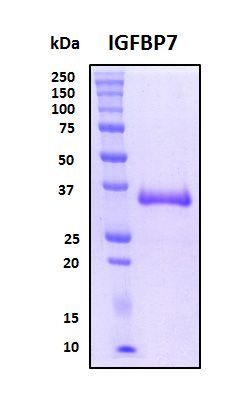 SDS-PAGE