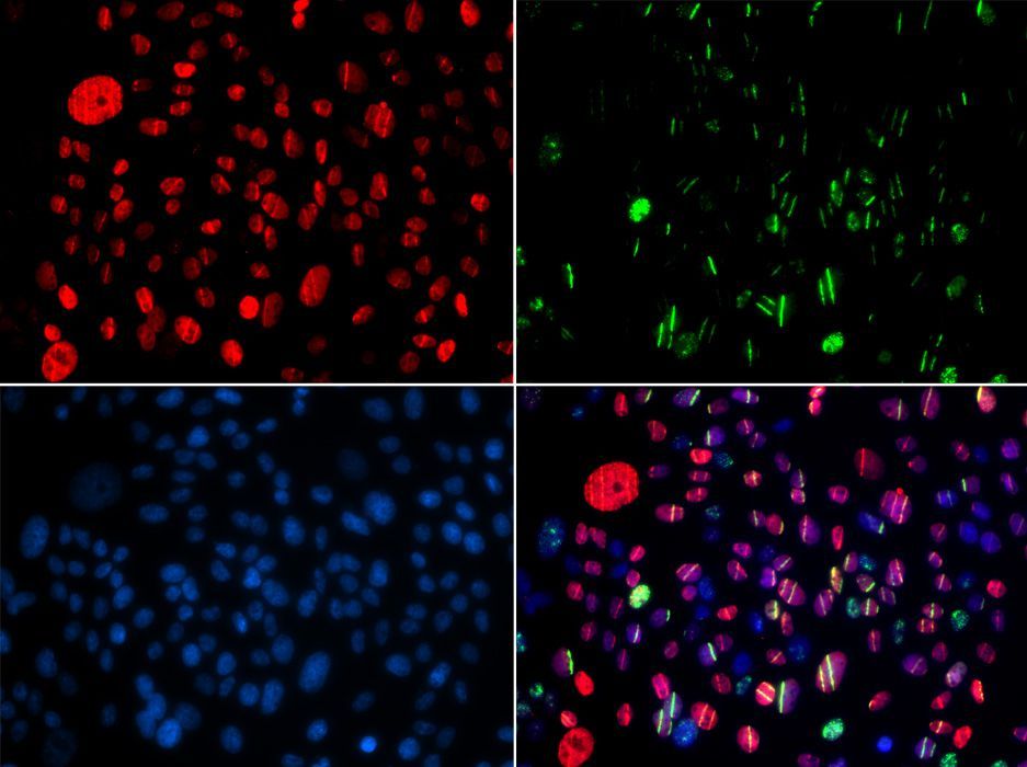 Immunofluorescence - Phospho-SMC1A-S957 pAb (144-50090)