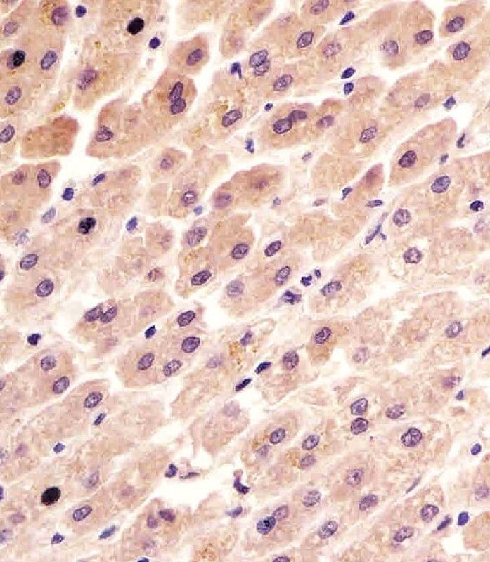IHC-P
