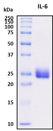 SDS-PAGE