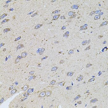Immunohistochemistry - ALDH1A1 antibody (144-01802)