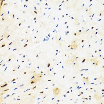 Immunohistochemistry - [KO Validated] SUZ12 Polyclonal Antibody (144-07786)