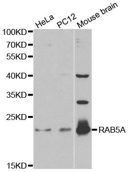 Western blot - [KO Validated] RAB5A Polyclonal Antibody (144-01180)