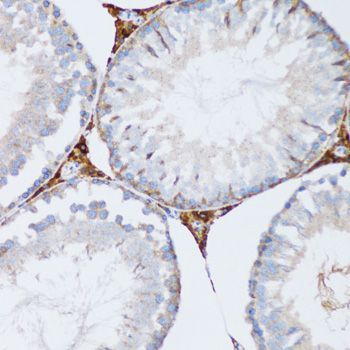 Immunohistochemistry - PGRMC1 antibody (144-05619)