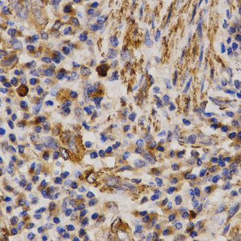 Immunohistochemistry - MMP25 Polyclonal Antibody (144-03032)