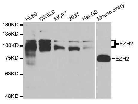 Western blot - EZH2 Polyclonal Antibody (144-011085)