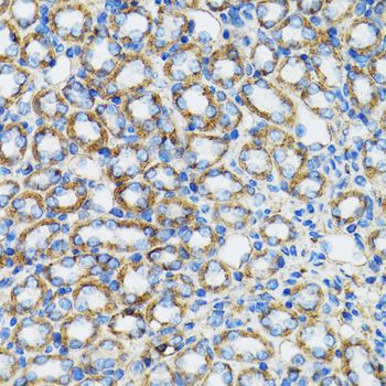 Western blot - CTNNA1 Polyclonal Antibody (144-05635)