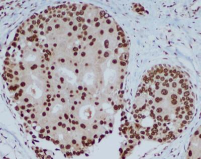 IHC