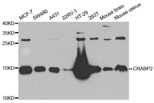 Western blot - CRABP2 Polyclonal Antibody (144-06119)