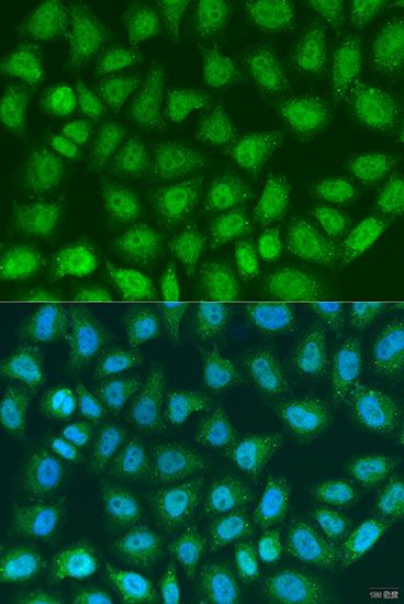 Immunofluorescence - SOCS4 antibody (144-08003)