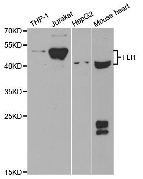 Western blot - FLI1 Polyclonal Antibody (144-05644)