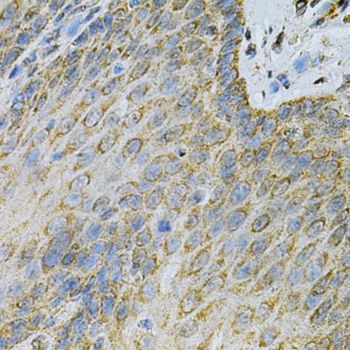 Immunohistochemistry - AK1 Polyclonal Antibody (144-603440)