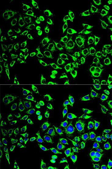 Immunohistochemistry - HSPD1 Polyclonal Antibody (144-00969)