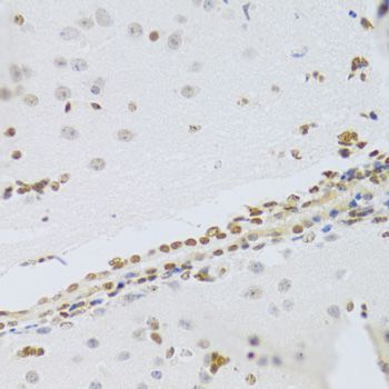 Immunohistochemistry - HMGB1 Polyclonal Antibody (144-02553)