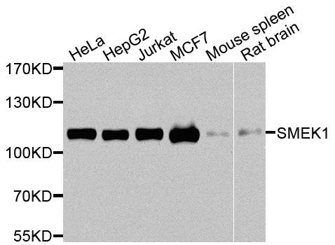 Western blot - SMEK1 Polyclonal Antibody (144-08500)
