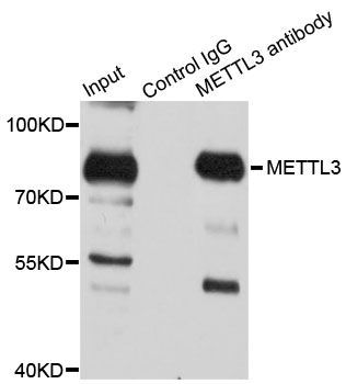 Immunohistochemistry - METTL3 Polyclonal Antibody (144-08370)