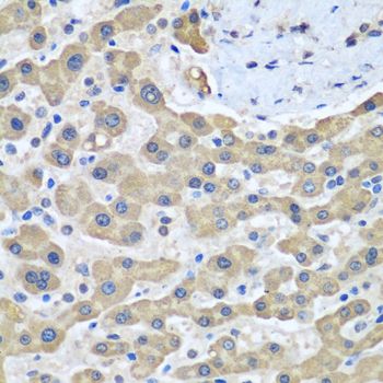 Immunohistochemistry - GFM1 Polyclonal Antibody (144-05077)