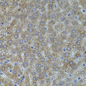 Immunohistochemistry - VEGFC antibody (144-02556)